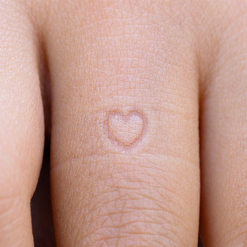 Close-up photo of a heart-shaped impression on a finger left by the Inner Message ring with a heart embossment